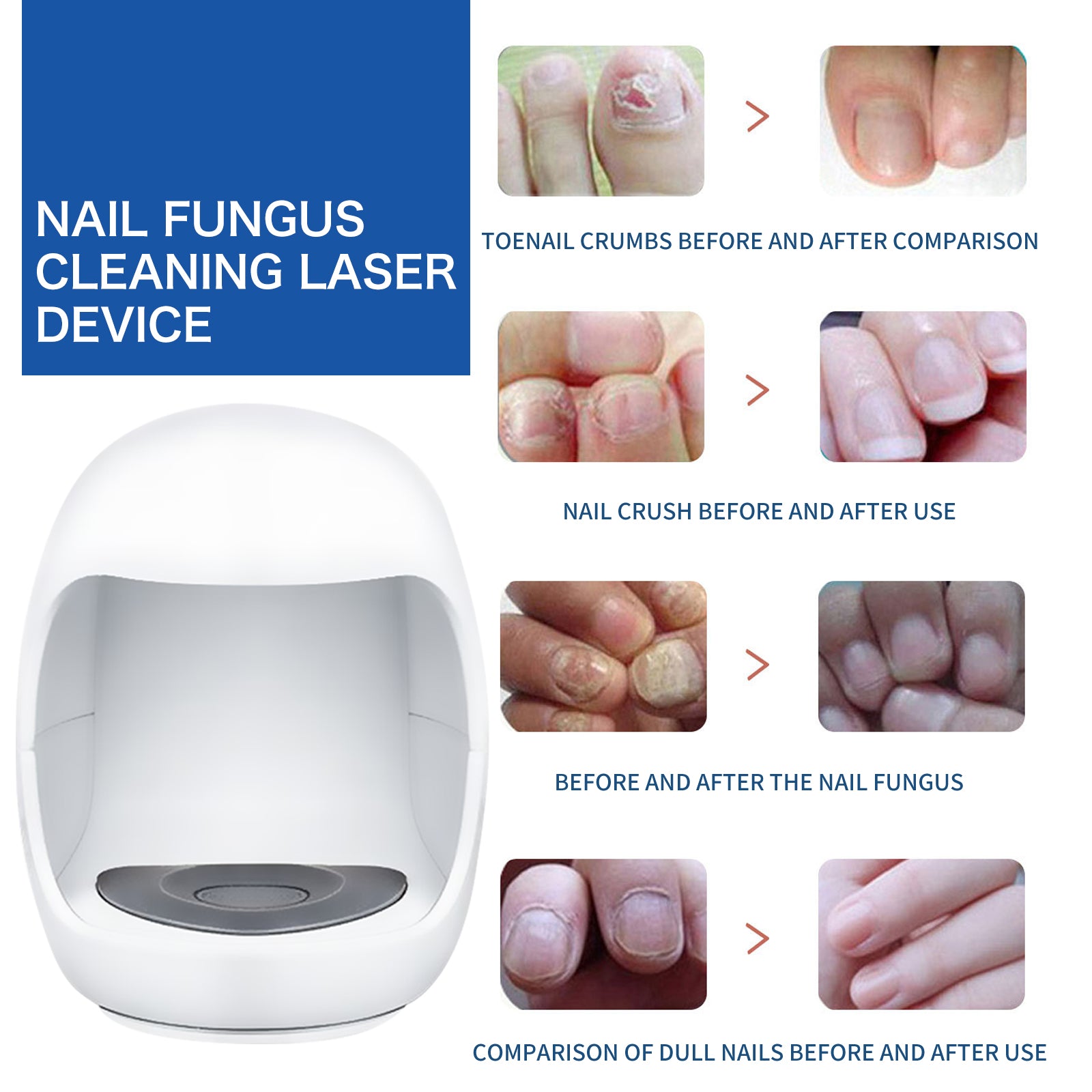 South Moon Nail Care Phototherapy Device, Repair Hands And Feet